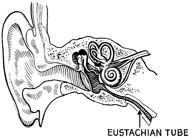 如果跑步时像基普乔格那样感觉耳朵被堵住了