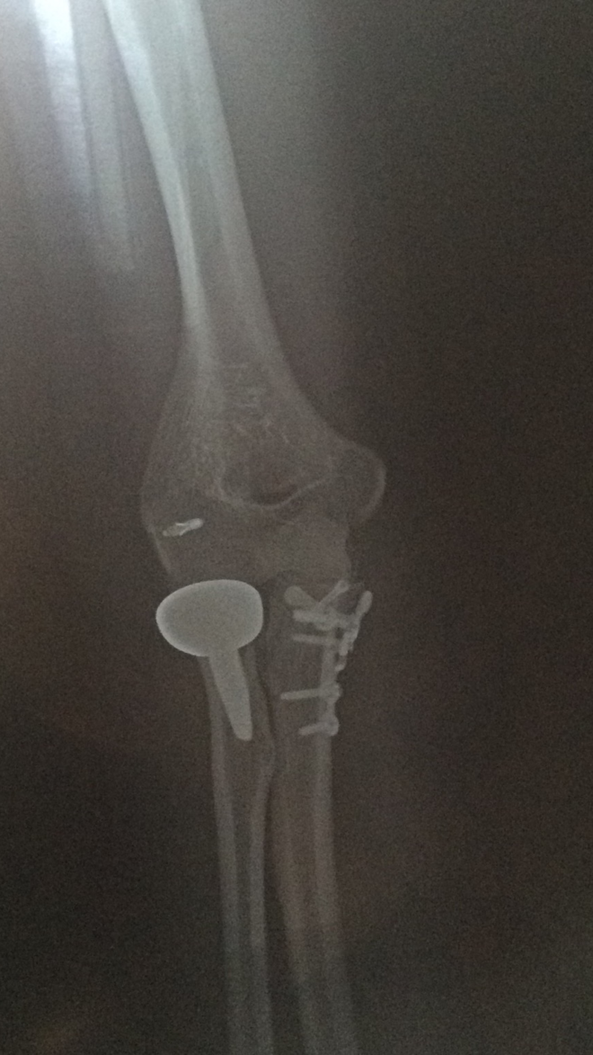 OpenRun Pro开放聆听，让天籁伴随奔跑